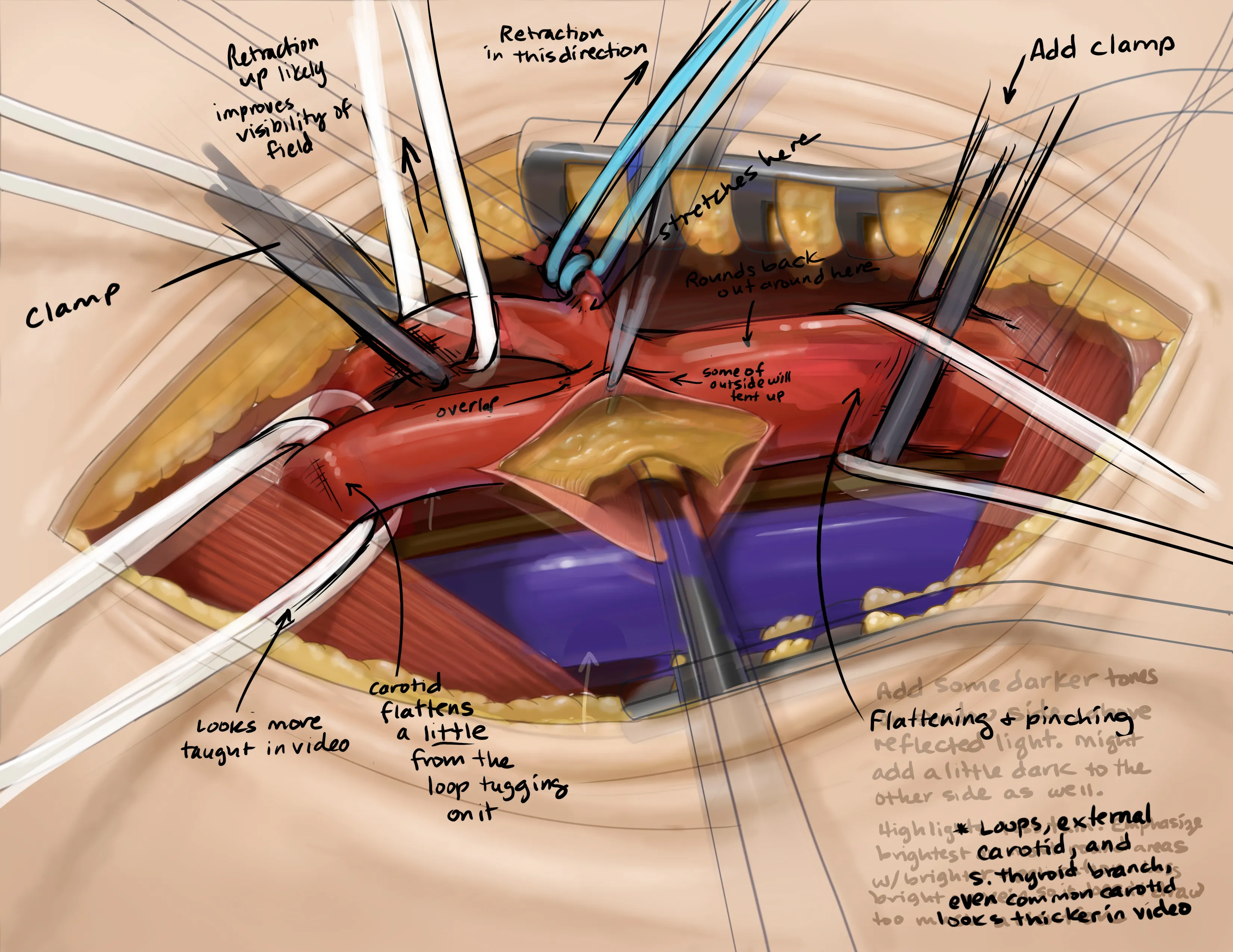 Illustration with neurosurgeon feedback annotations