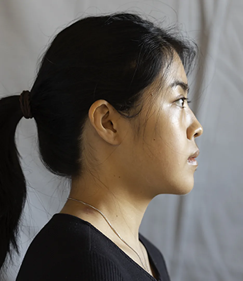 Blood Supply to Muscles of Mastication - Step 1