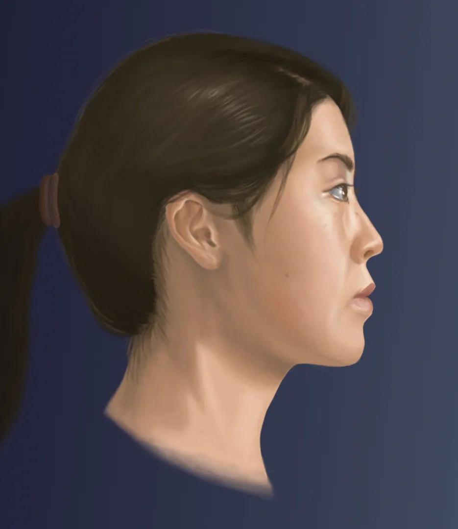 Blood Supply to Muscles of Mastication - Step 2