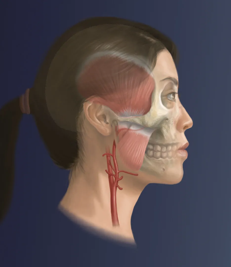 Blood Supply to Muscles of Mastication - Step 4