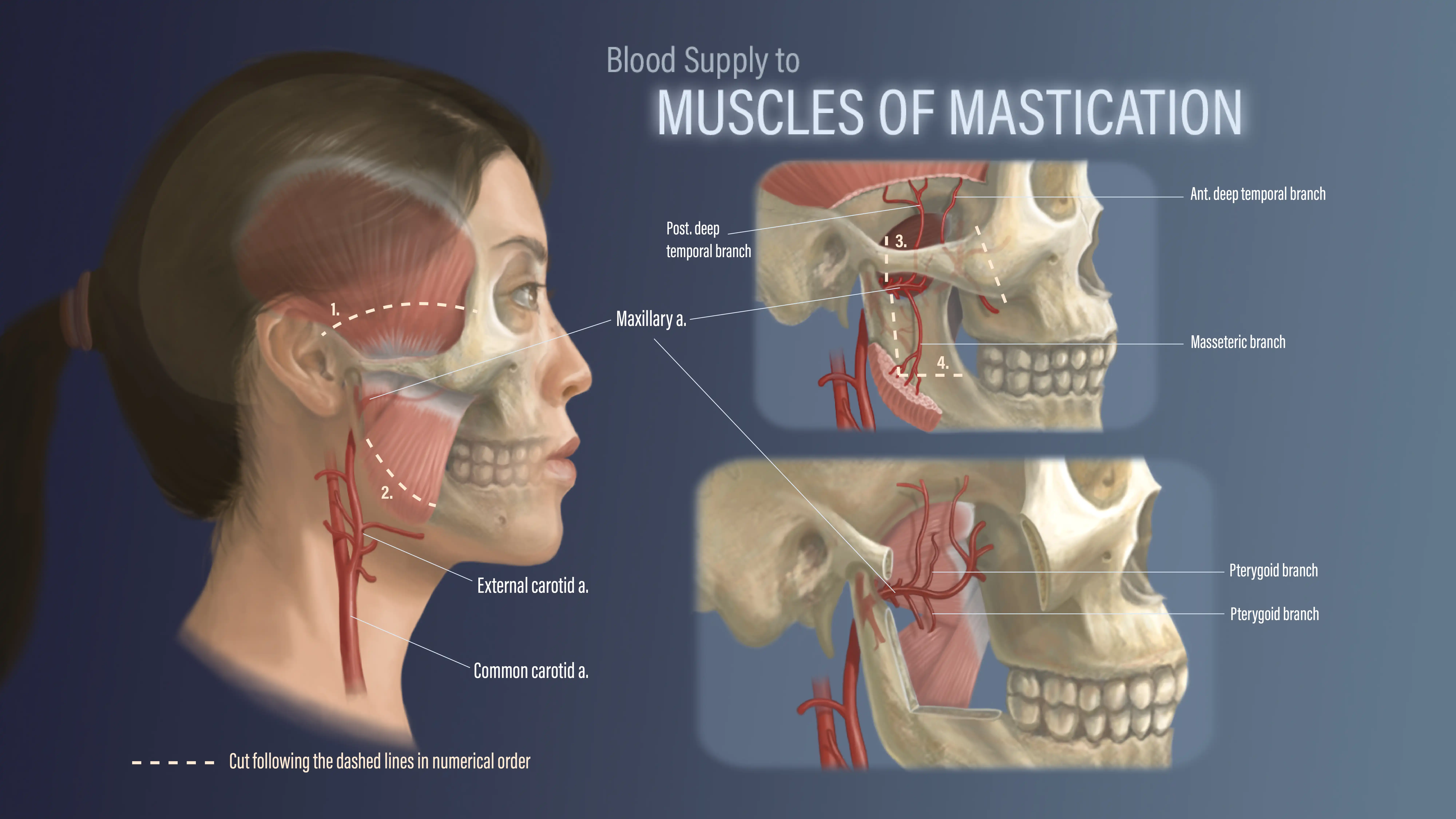 Blood Supply to Muscles of Mastication - Photoshop, Illustrator, 2023